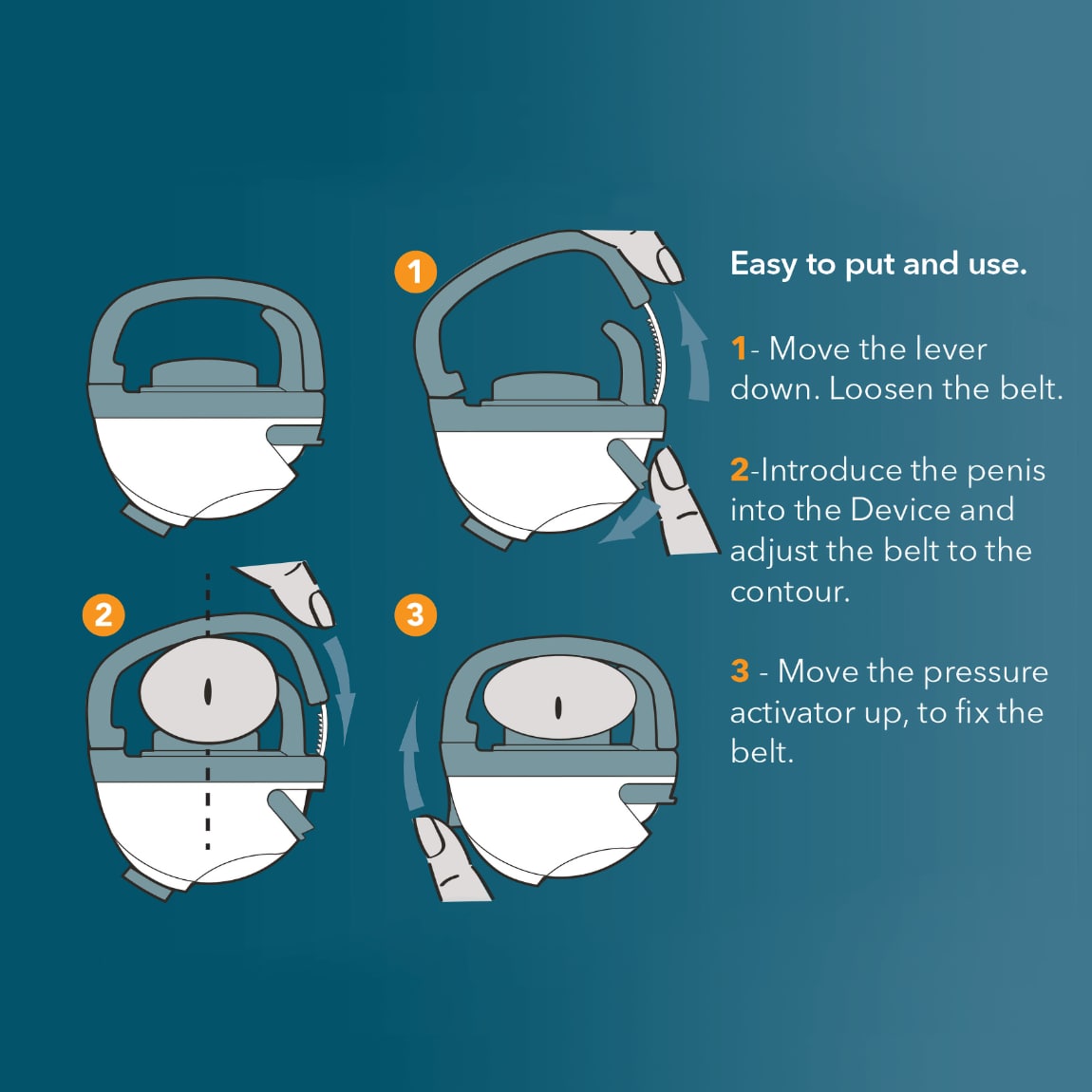 Harex Urinary Incontinence Medical Device